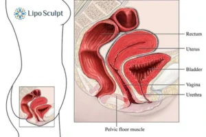 Treatment For A Leaky Bladder 2 How EM Chair treatment Billericay can help Leaky bladder issues. Read more now!