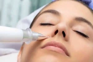 Best Actinic Keratoses Removal 3 Actinic keratoses Billericay solutions - book in today!