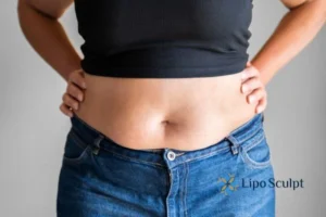 Bidding Farewell to Muffin Tops with Aqualyx Fat Injections 2 Do you wish you could reduce your muffin top Billericay With Aqualy fat dissolving injections you can!